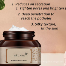 Creme anti-acne / creme anti-acne / creme para remoção de cicatrizes de acne Meiyanqiong Creme clareador coreano para remoção de cicatrizes de ervas